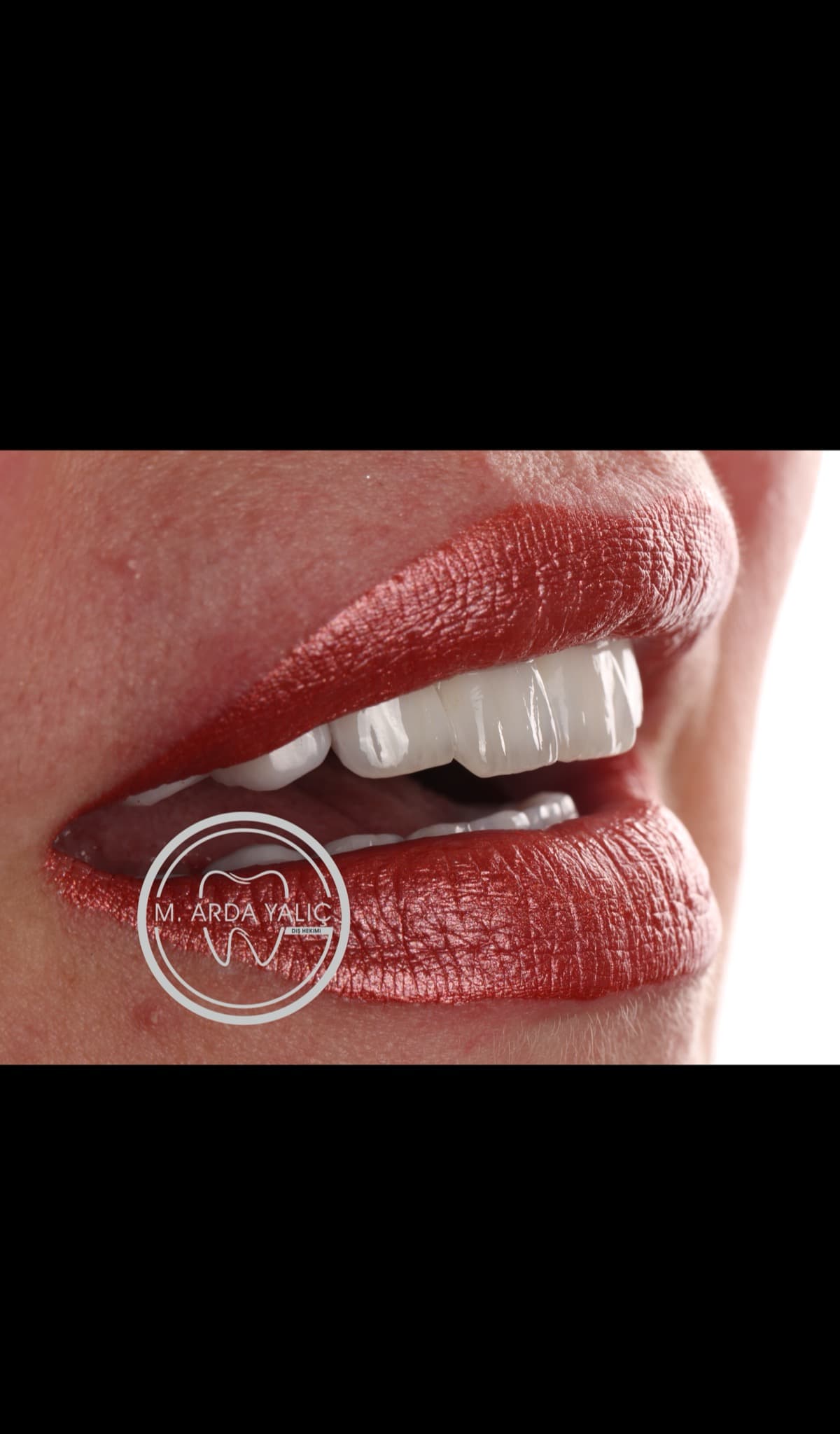 Dental treatment before and after result 07