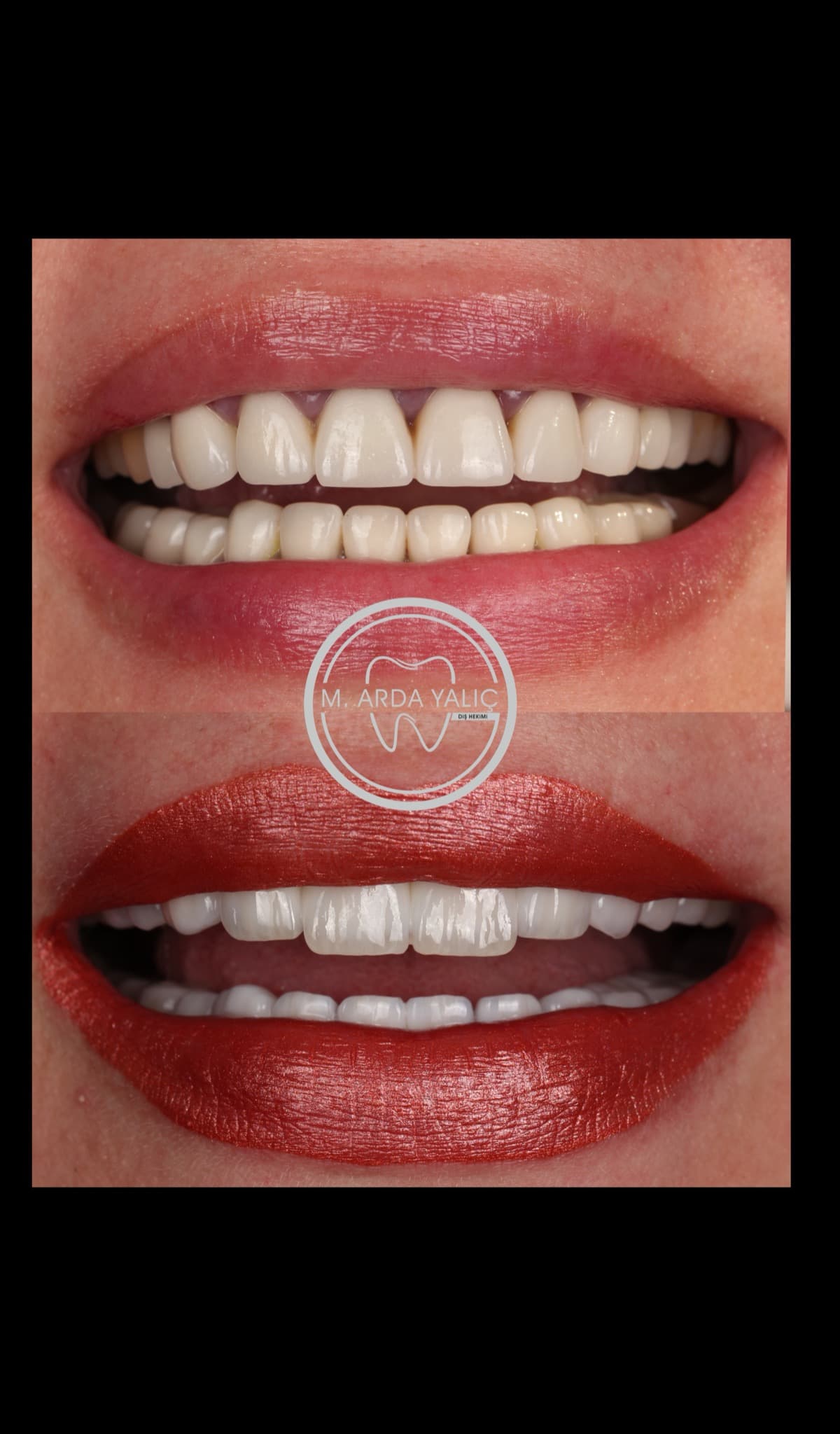 Dental treatment before and after result 08