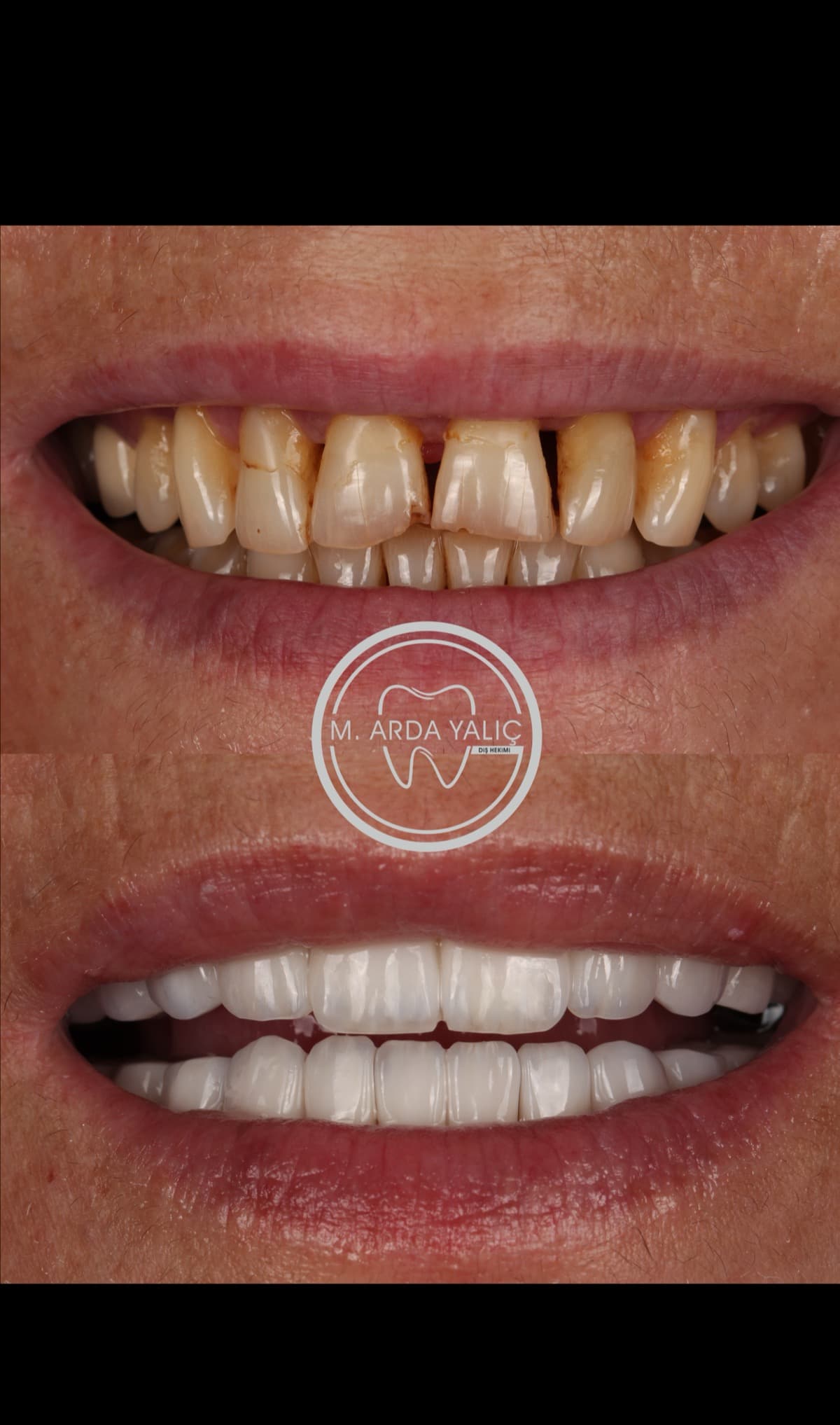 Dental treatment before and after result 18