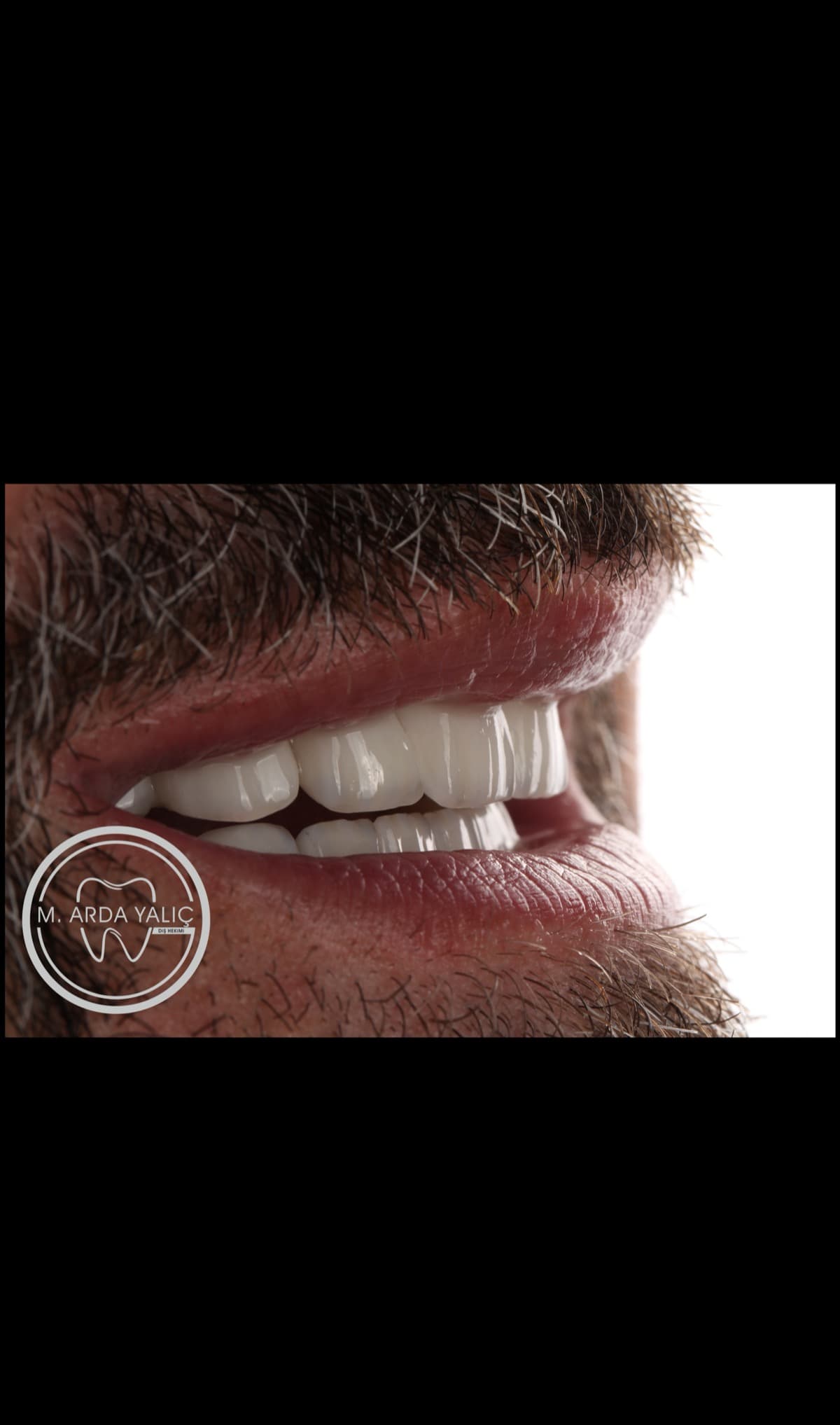 Dental treatment before and after result 26