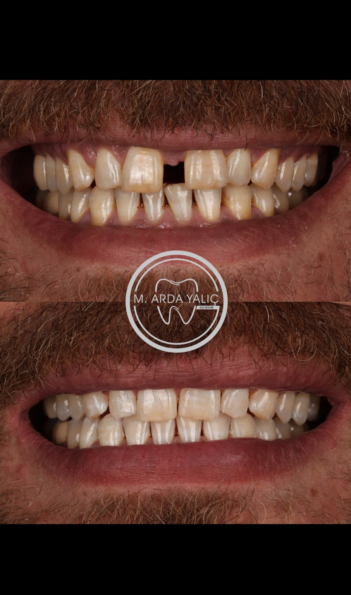 Dental treatment before and after result 27
