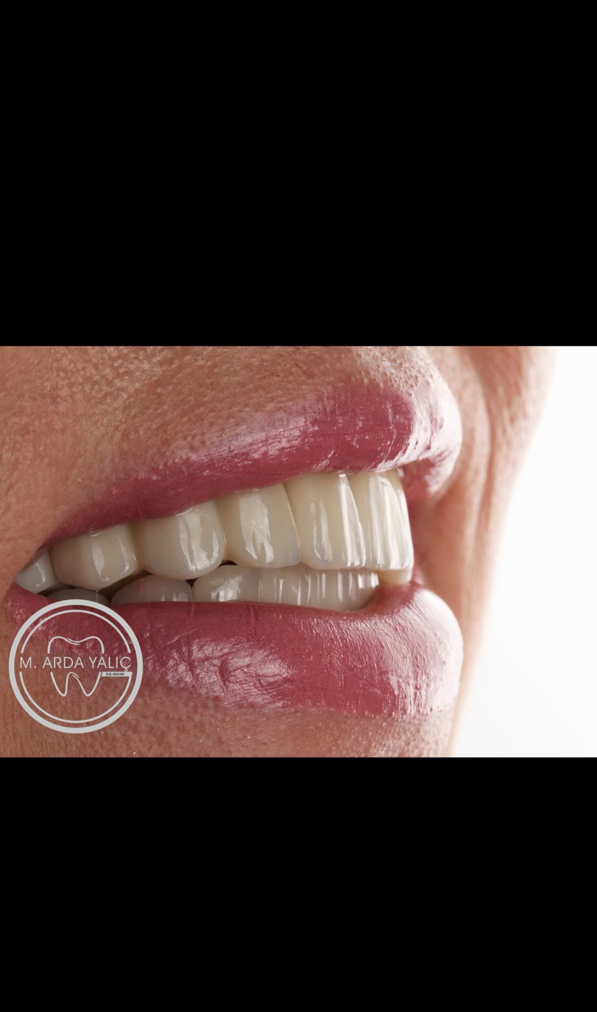 Dental treatment before and after result 29