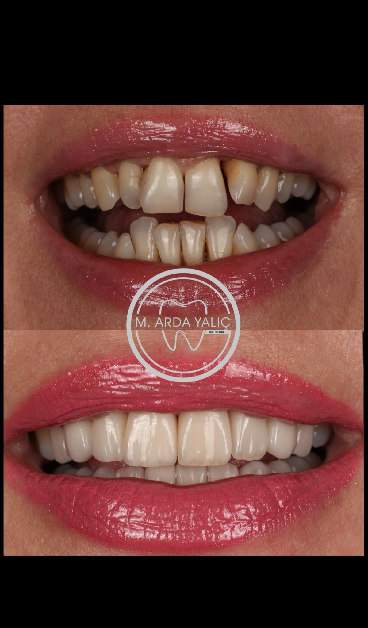 Dental treatment before and after result 12