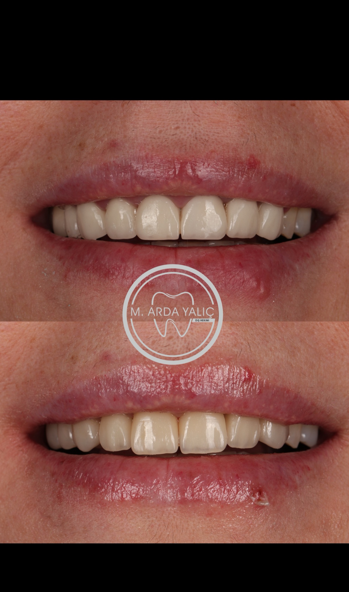 Dental treatment before and after result 15