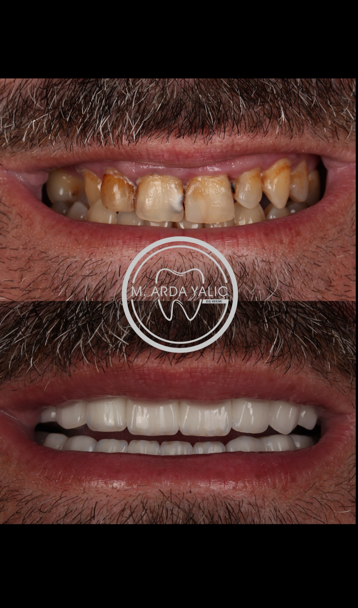 Dental treatment before and after result 25