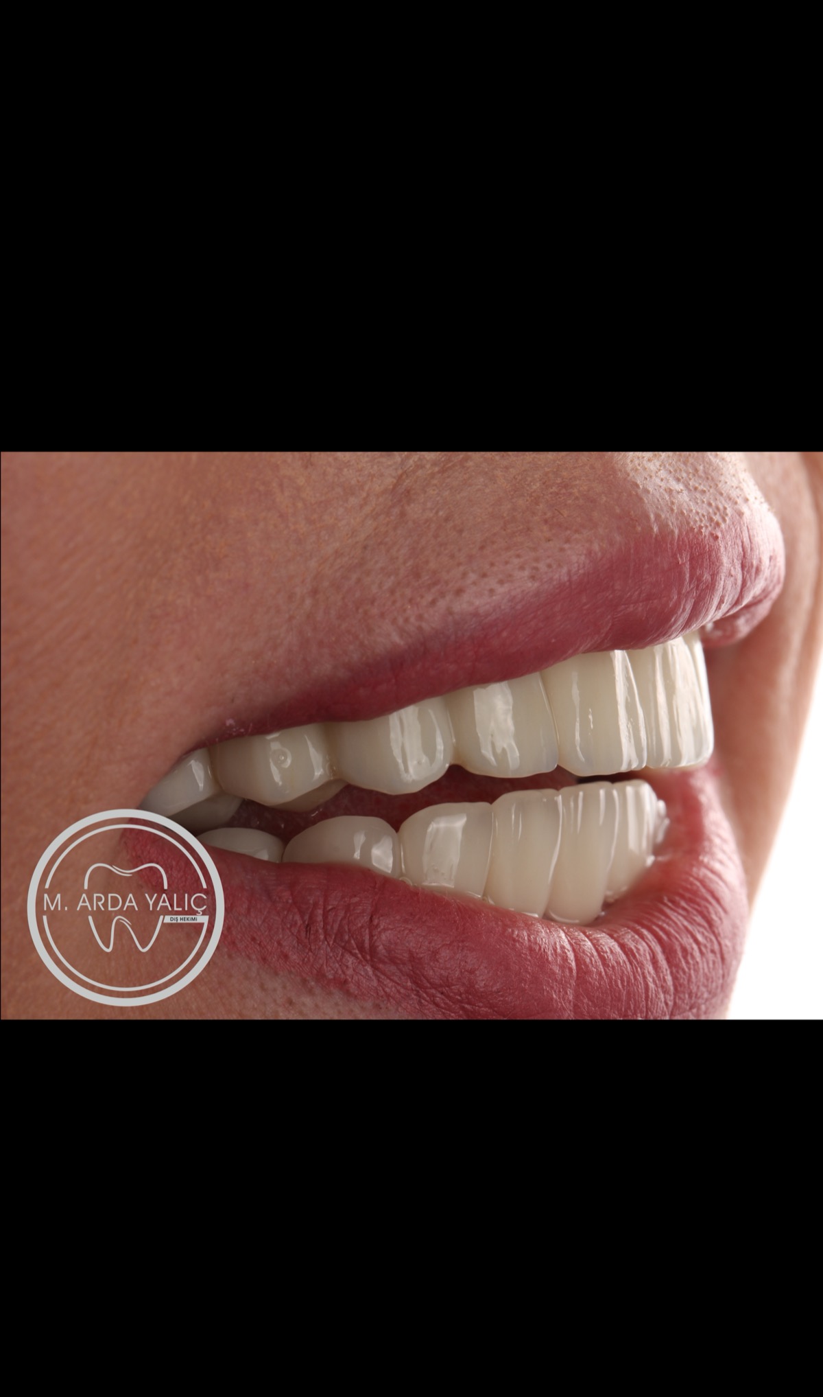 Dental treatment before and after result 28