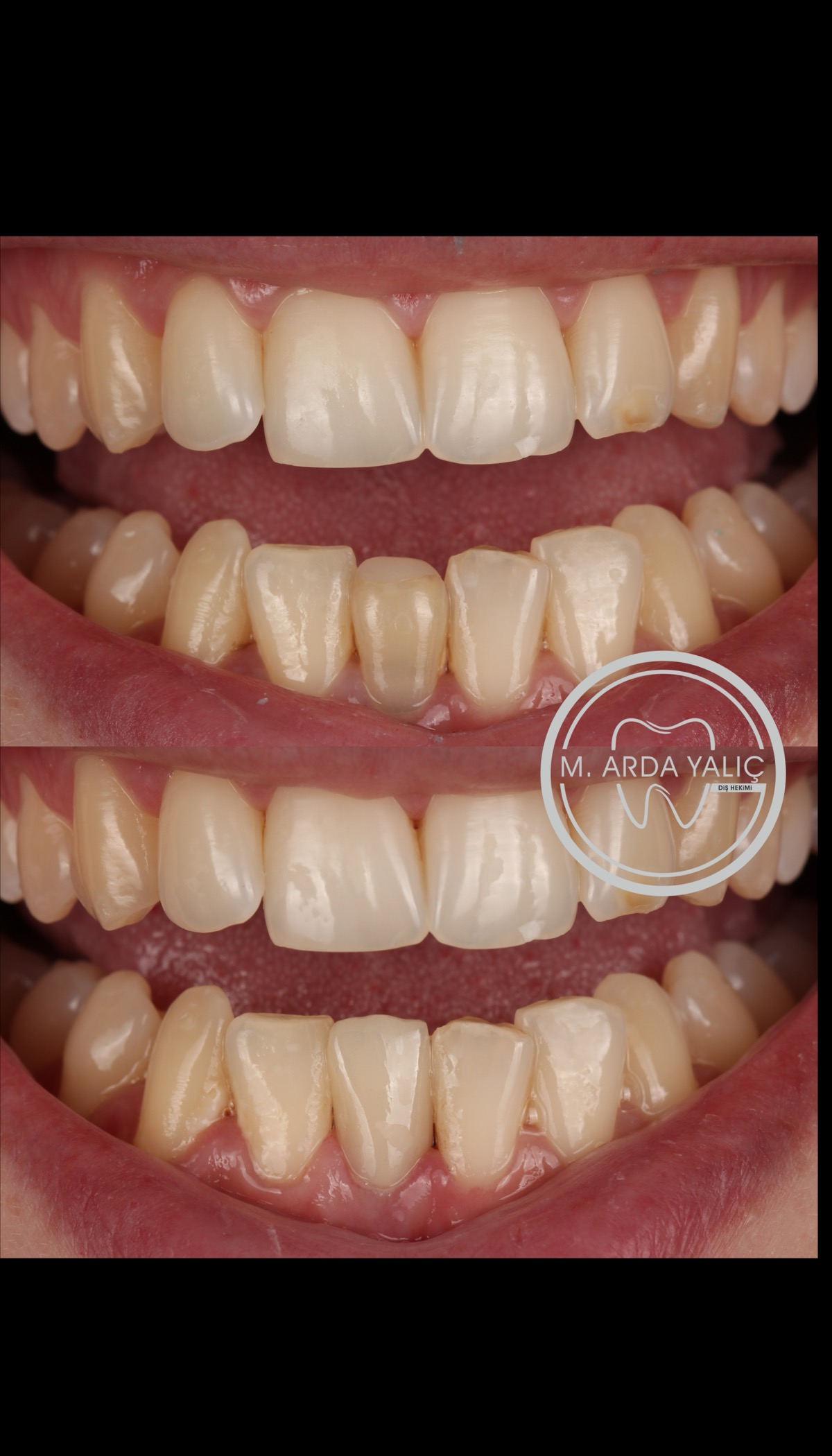 Dental treatment before and after result 31