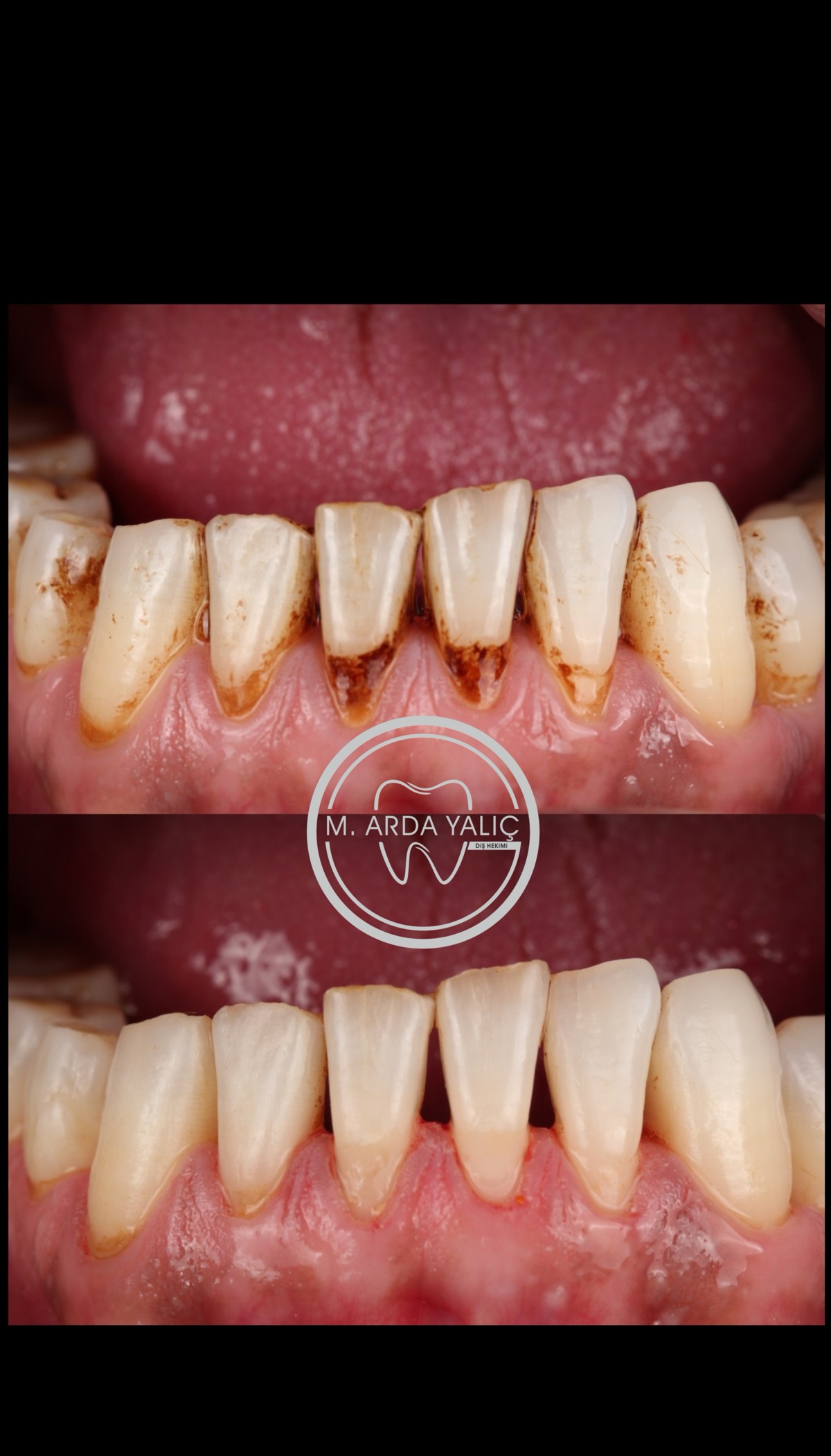 Dental treatment before and after result 34