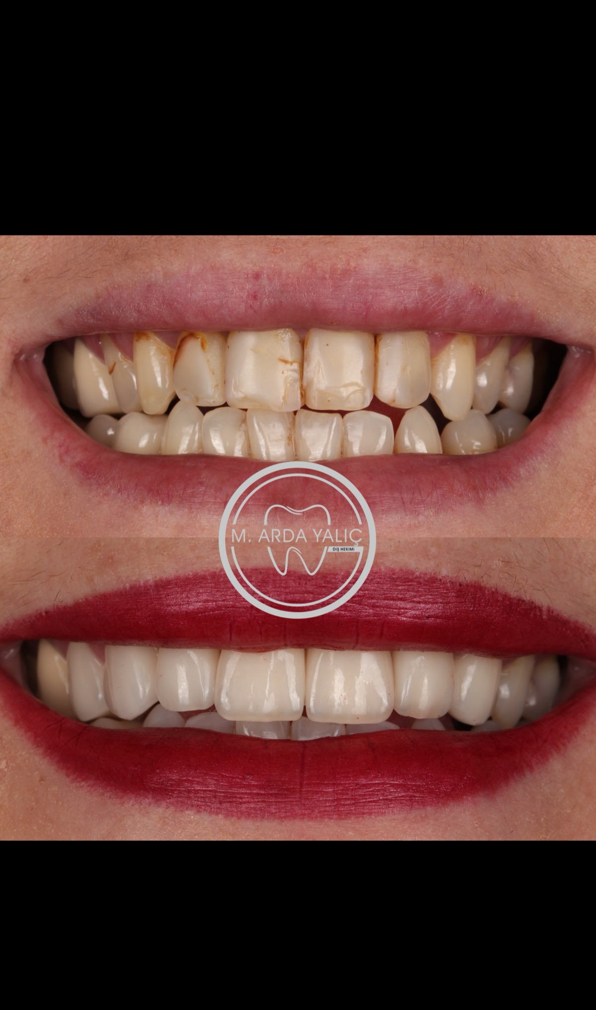 Dental treatment before and after result 37